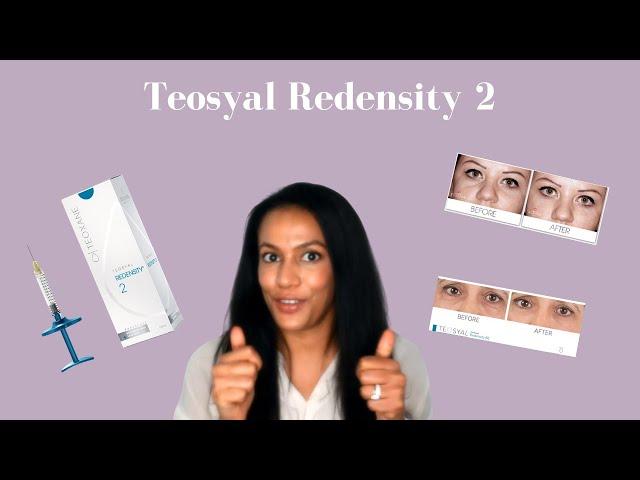 Teosyal Redensity 2 Under Eye Filler - Tear Trough Filler Explained!
