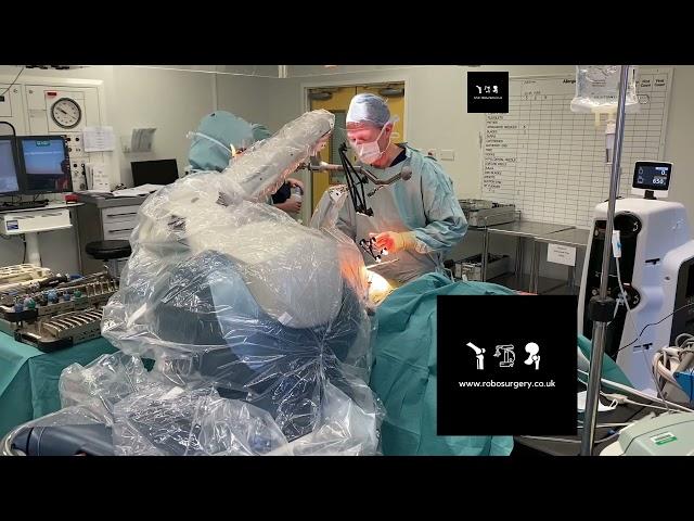 Jon Conroy Mako Total Hip Replacement