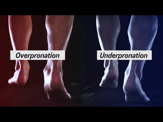 How to Determine your Pronation