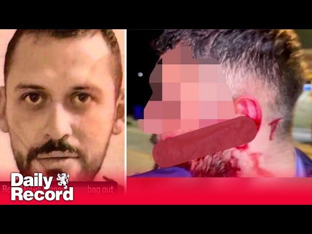 Gangster who sparked Scotland's violent drug war pictured after brutal revenge slashing