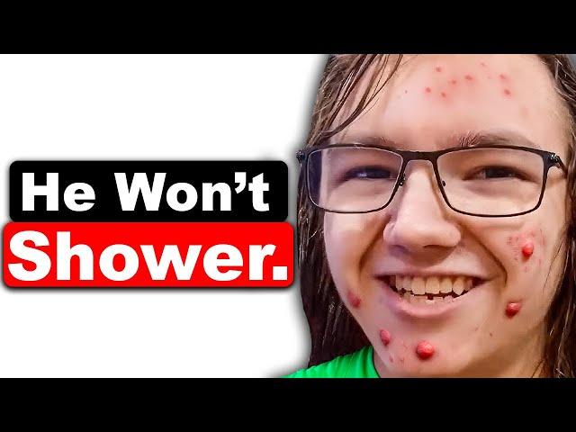 The TikToker Who REFUSES To Shower Is SO Disgusting...