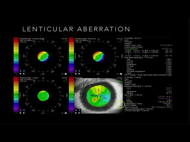 AIOC2018 - GP117 - Topic - Tracey Technology: Getting the Aberrations