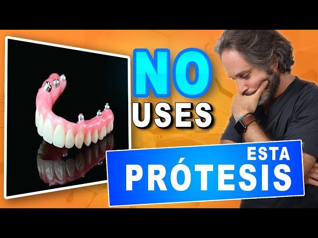 Prótesis 𝗛𝗜𝗕𝗥𝗜𝗗𝗔𝗦 𝘀𝗼𝗯𝗿𝗲 𝗜𝗠𝗣𝗟𝗔𝗡𝗧𝗘𝗦 Ventajas y Desventajas.Prótesis Dental Fija que  RECOMIENDO ️