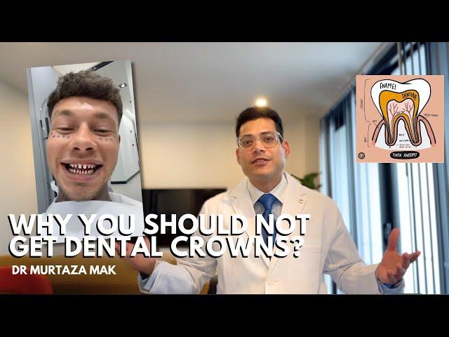 Why You Should Not Get Dental Crowns? The Unfortunate Truth