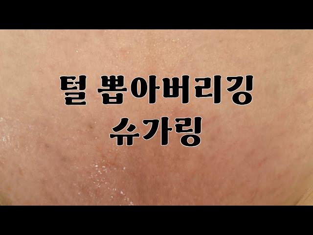 브라질리언 삼각존 털뽑기 | 슈가링 방법 | 슈가링 브라질리언