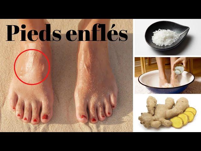 Remèdes maison pour les pieds gonflés - Sante Naturelle