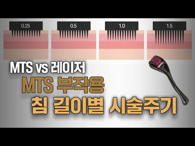 MTS 침길이별 효과 or 부작용 | MTS 전문채널 NO.1 MTS전도사