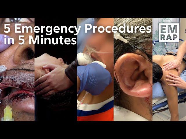 5 Emergency Procedures in 5 Minutes!