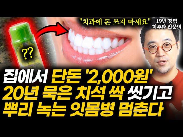 "치과에서 환자한테 권합니다" 19년 치주과 전문의가 꽁꽁 숨겨둔 집에서 2,000원으로 녹는 잇몸병 멈추고 묵은 치석 싹 씻기는 가장 쉬운 방법 (박정철 원장 2부)