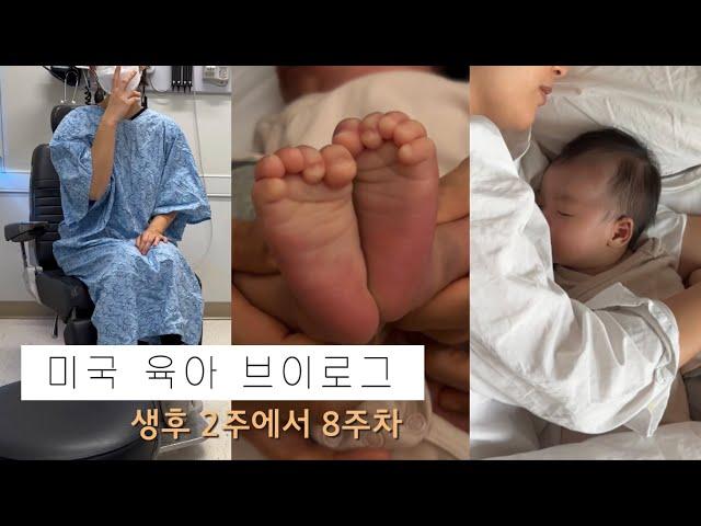 [미국 일상] 엄마랑 산후조리. 수면교육. 설소대 단축증. 모유수유 상담. 유선염. 똑게육아. 혼합수유. Nanit Baby Monitor. Nestig.