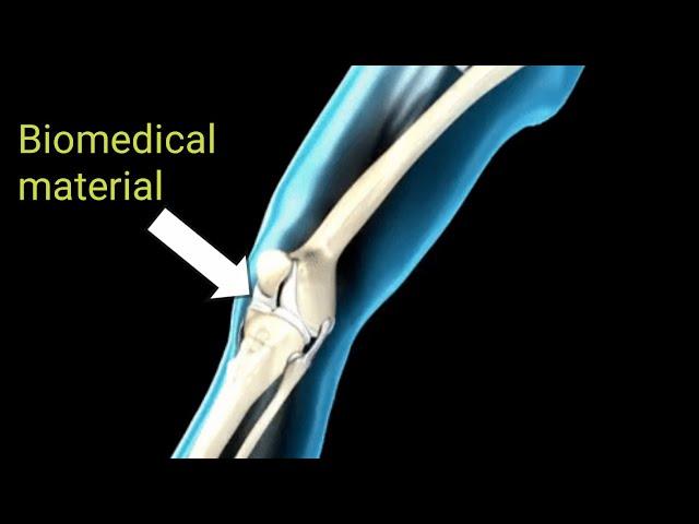 Introduction To Biomedical Materials