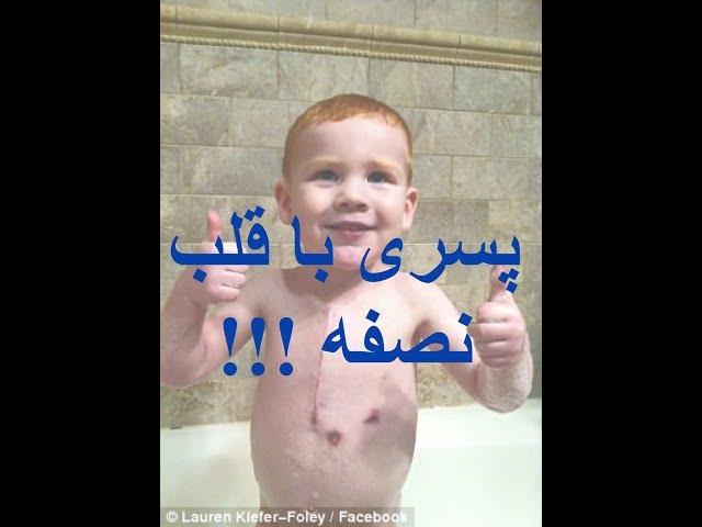 پسری که با قلب نصفه به دنیا آمد و باعث حیرت پزشکان شد + تصاویر