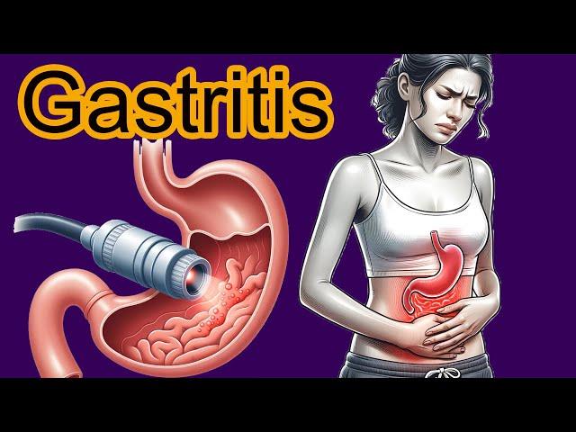 5 Early signs of Gastritis.  Gastritis diagnosis and treatment