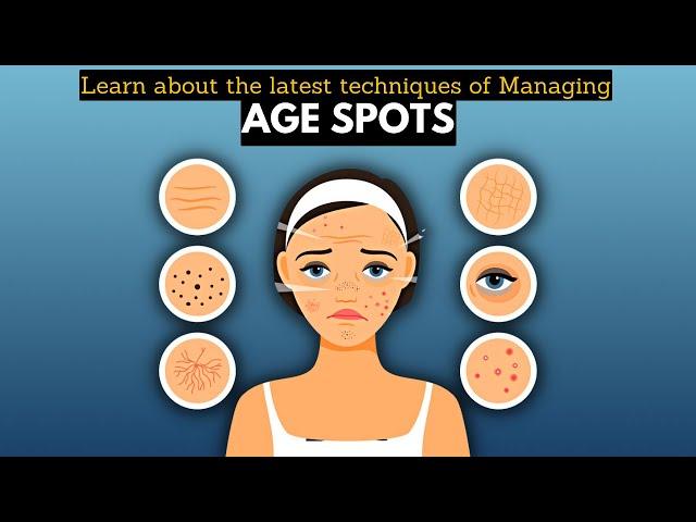 Learn About the Latest Techniques for Managing Age Spots