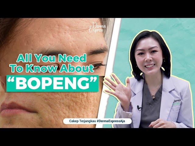 MUKA BOPENG BISA JADI MULUS LAGI! - All You Need To Know About by @derma_express