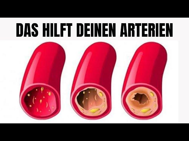 Reinige deine Arterien mit nur 3 Zutaten