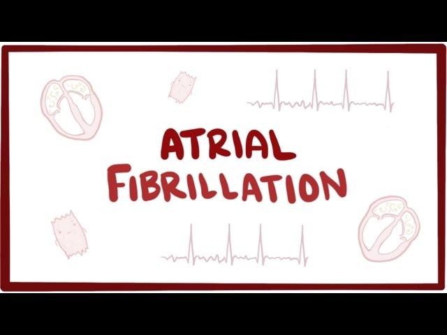 Atrial fibrillation (A-fib, AF) - causes, symptoms, treatment & pathology