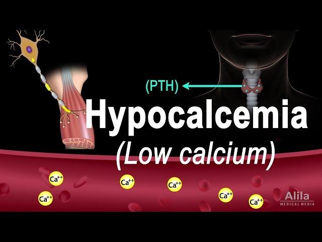 Hypocalcemia (Low Calcium) Pathology, Causes, Symptoms and Treatment, Animation