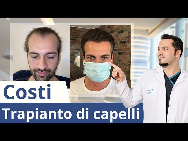 Quanto costa un trapianto di capelli? Lo spiega il dottor Balwi