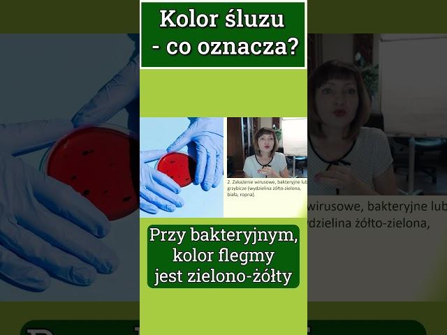 Kolor flegmy - co oznacza?