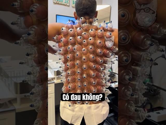 Có Đau Không? 