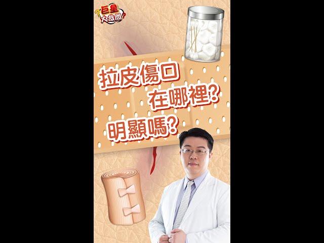 拉皮很可怕?! 專業解析: 拉皮傷口在哪裡? 會很明顯嗎?  #shorts
