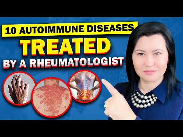 Top 10 Autoimmune Diseases A Rheumatologist Diagnose and Treat