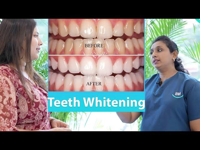 Teeth Whitening... Smile Kochi Dental Clinic +91 7999995339, +91 8877077079