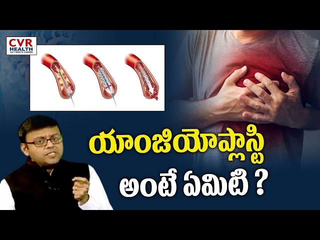 యాంజియోప్లాస్టి అంటే ఏమిటి ? | What is angioplasty? | CVR Health