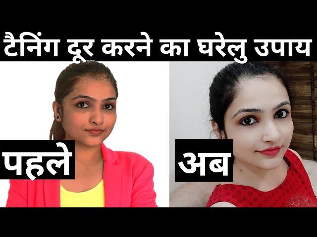 सन टैनिंग हटाने के घरेलू आसान उपाय | Sun Tan Removal Home Remedy | Remove tan | skin detan|detanned