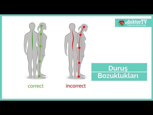 Duruş Bozuklukları | Dik Duruş | Postür Düzeltme | Kamburluk | Doç.Dr.Saliha DEMİR EROĞLU