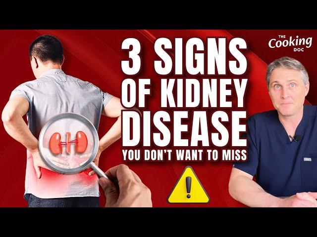 3 Signs of Kidney Disease You Don't Want to Miss