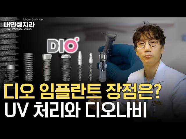 디오 임플란트 장점은?