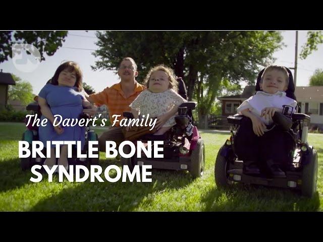 The Daverts: Brittle Bones & Cerebral Palsy