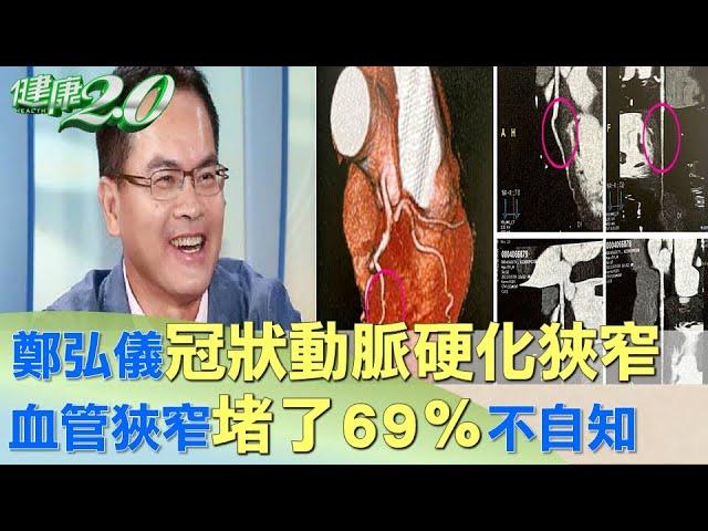 鄭弘儀冠狀動脈硬化狹窄 血管狹窄"堵了69％"不自知 健康2.0