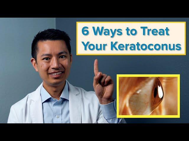 The 6 Best Ways to Treat Your Keratoconus: Orange County Eye Doctor Explains