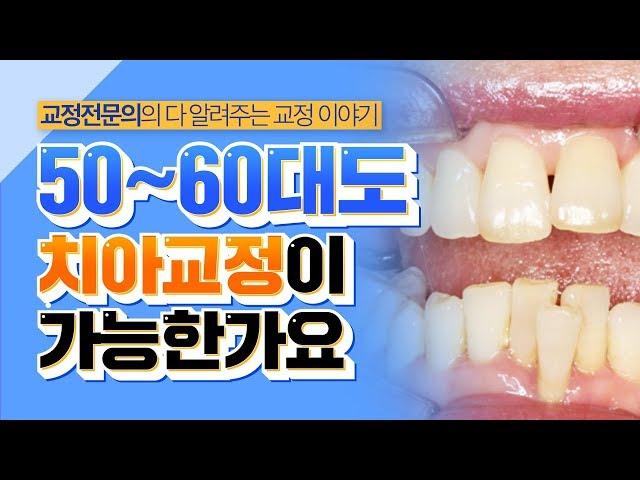 50대, 60대 나이들어도 치아교정이 가능한가요? 어르신 치아교정, 중년 치아교정, 노인교정