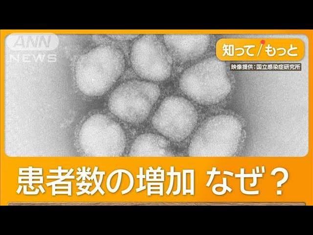 インフルエンザ「pdm09型」猛威　2009年にも大流行　医師「免疫持つ人少ない」【知っておきたい！】【グッド！モーニング】(2024年12月29日)