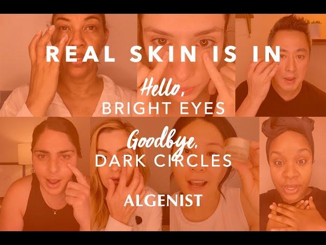 Real Skin is In | Algenist Triple Algae Eye Renewal Balm 10-Day User Video Testimonials | Teaser