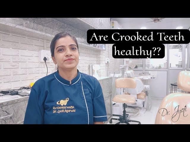 Are Crooked teeth healthy?? | malaligned teeth | unhealthy teeth causes | Dr. Jyoti Agarwal