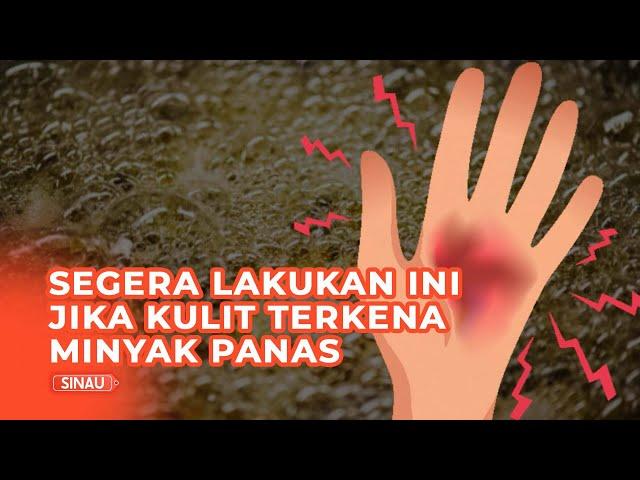 Cara Alami Mengobati Luka Terkena Percikan Minyak Panas, Apa Saja?