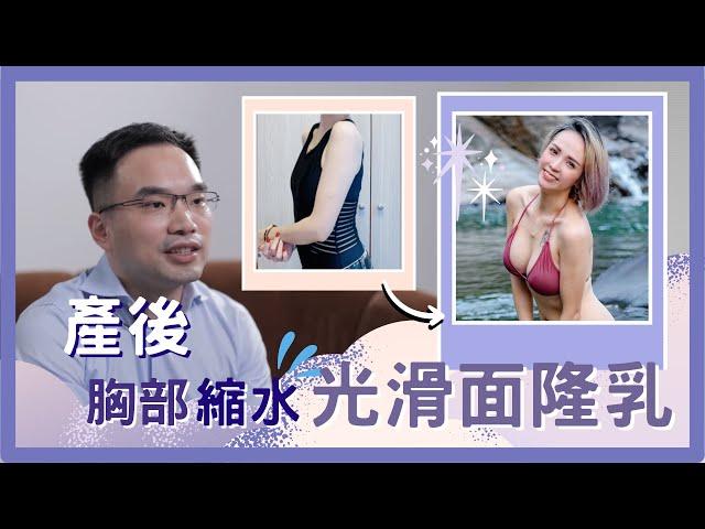 【台中隆乳】產後胸部縮水，光滑面隆乳|王冠穎醫師