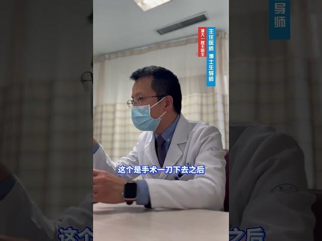 颈部拉伸要充分 #甲状腺癌术后 #甲状腺结节 #抖出健康知识宝藏