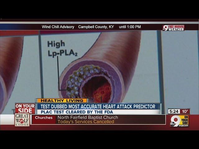 Plac test cleared by FDA can predict heart attack