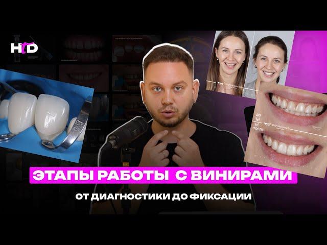 Виниры. Этапы работы | PROвиниры Прокопович Виктор