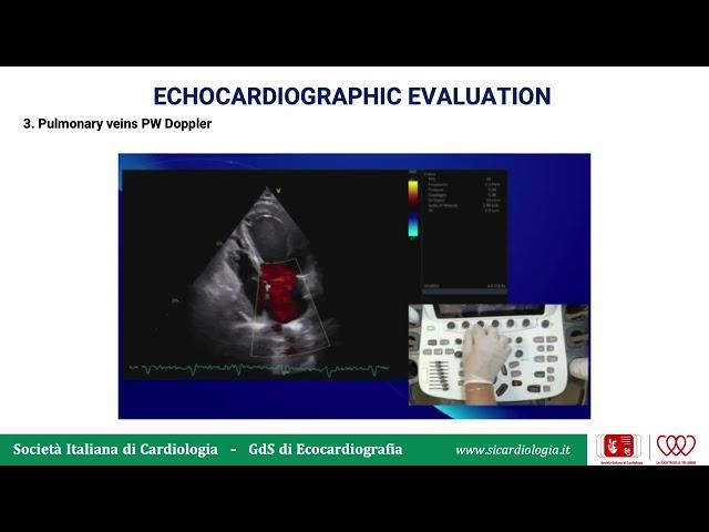 Echo Toolbox: Valutazione Ecocardiografica della Funzione Diastolica