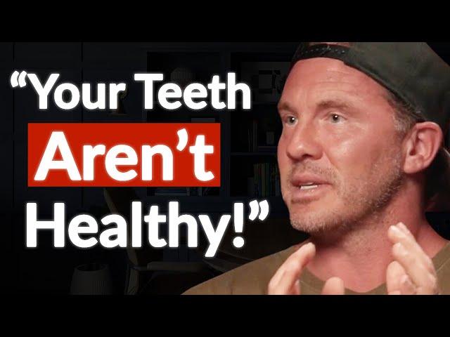 "Fix This Early On!" - How Root Canals Decrease Your Lifespan & Cause Disease | Dr Dominik Nischwitz