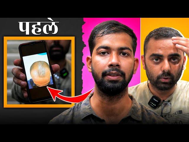 "यही है Dr. A Khan की Reality" | Pateint Review | Hairfall Treatment