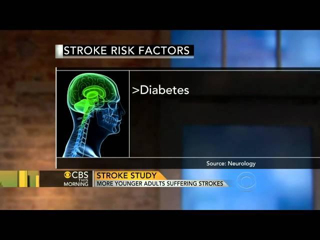 Study: More young adults suffering strokes