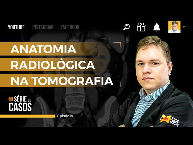 ANATOMIA RADIOLÓGICA NA TOMOGRAFIA